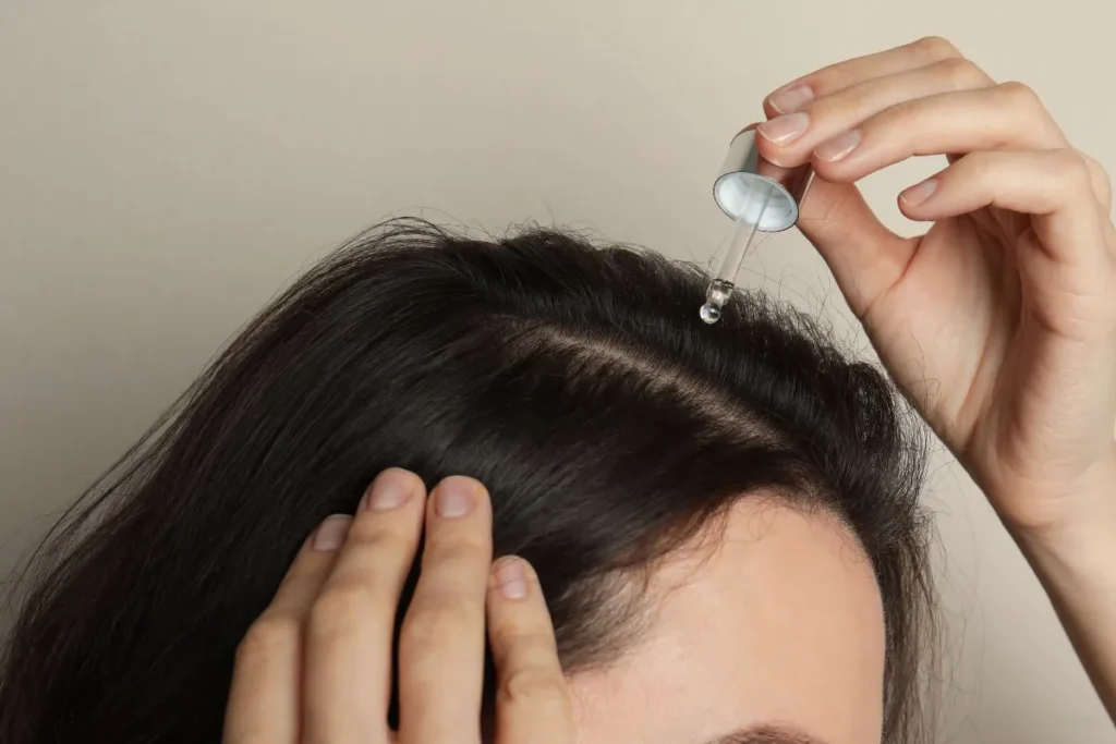 Finasteride Before And After: Big Changes