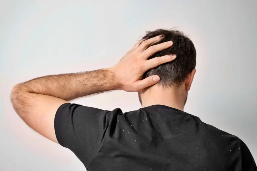 Why Is My Scalp Red? 5 Scary Root Causes