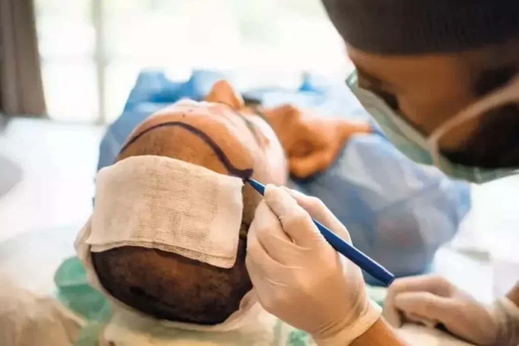 Wide Hair Parting Loss: 5 Powerful Cures