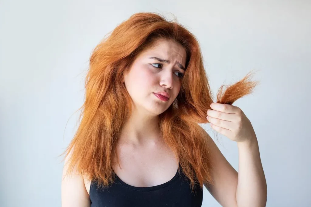 Hair Dry And Falling Out: 7 Amazing Fixes