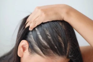 Common causes of hair thinning at age 19
