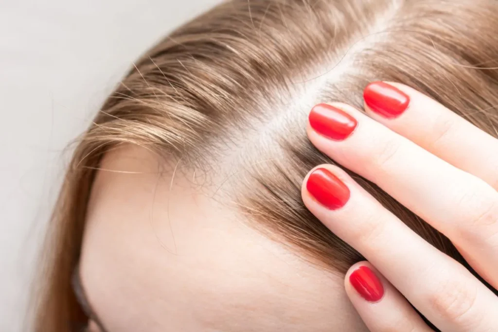 Hair Thinning On Sides: Amazing Powerful Fix