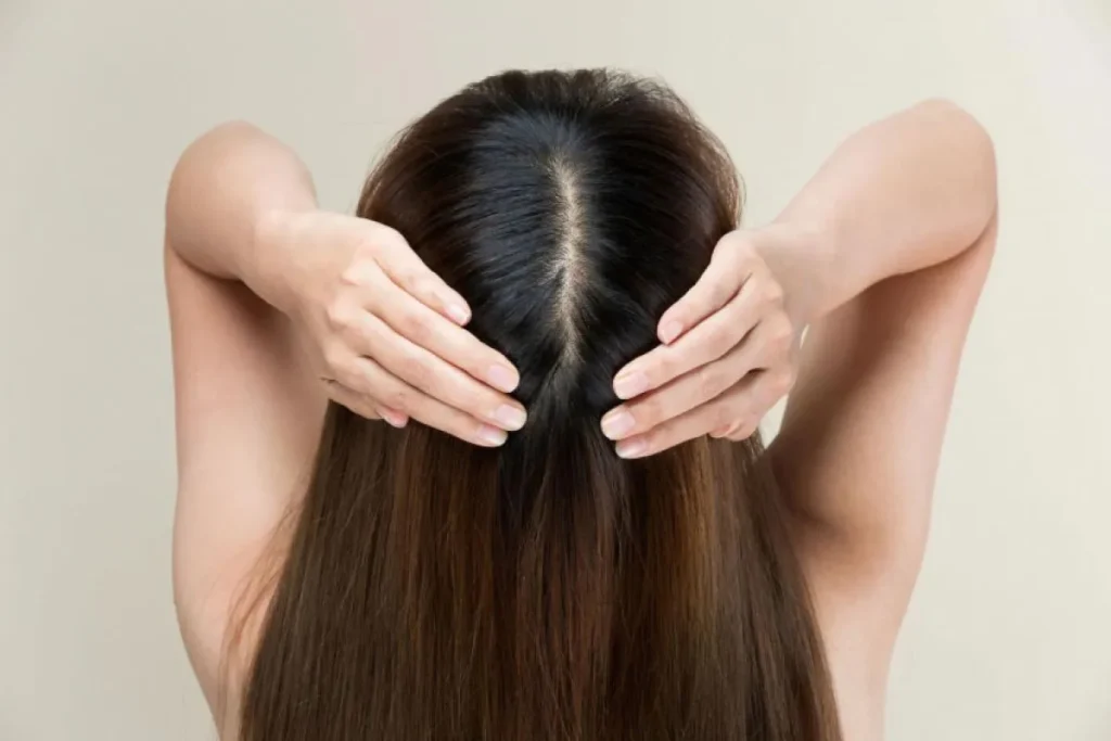 Healthy Scalp: Amazing Powerful Secrets