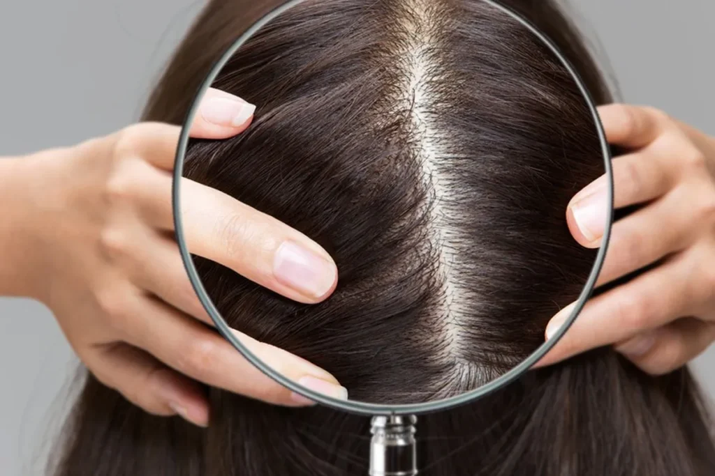 Healthy Scalp: Amazing Powerful Secrets