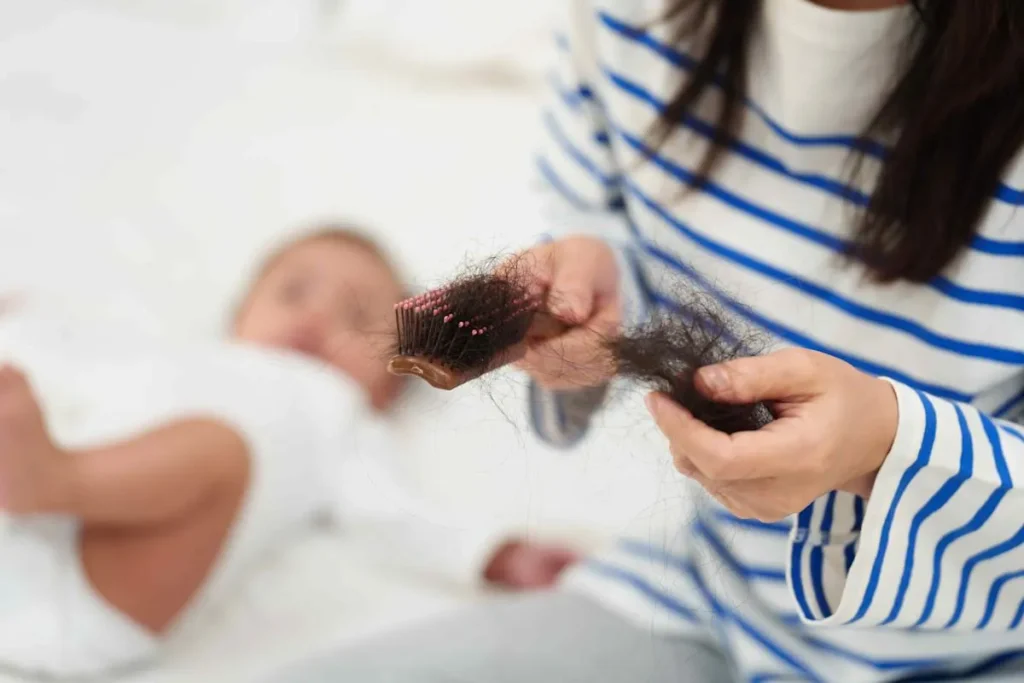 How Long Does Postpartum Hair Loss Last?