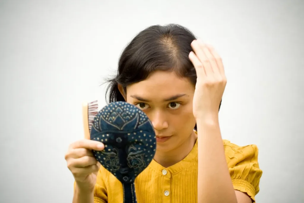 Home Remedies For Hair Loss: Amazing Wins
