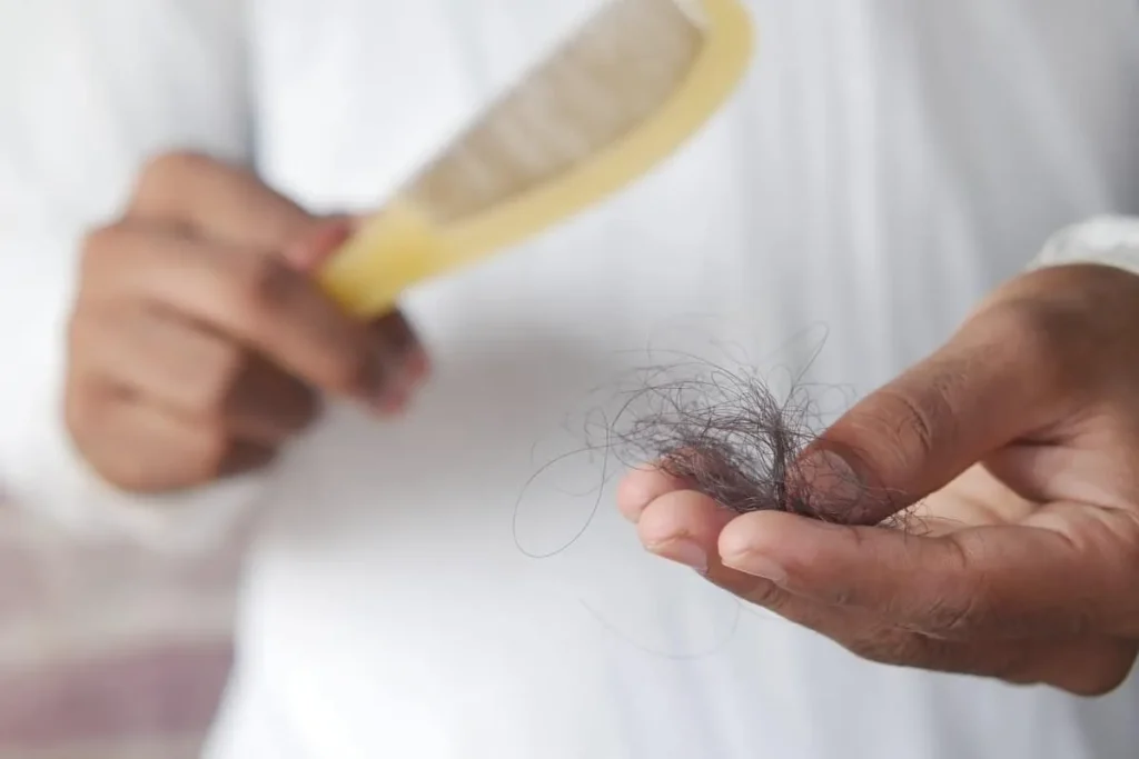 Does Stress Make You Lose Hair? Scary Truth