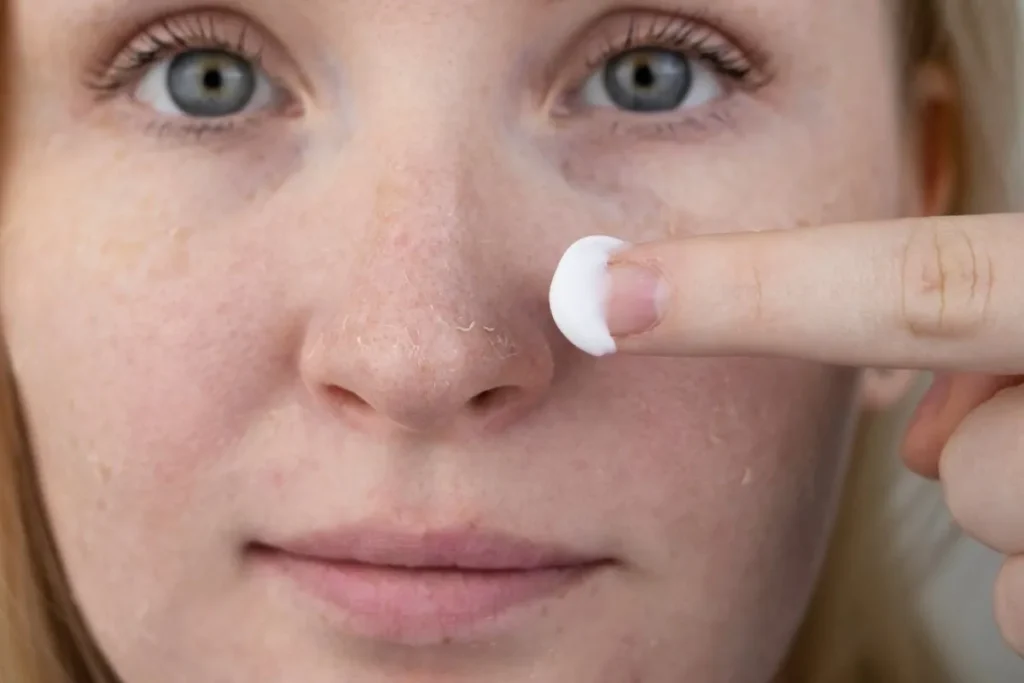 Dry Skin On Forehead: Amazing Solutions