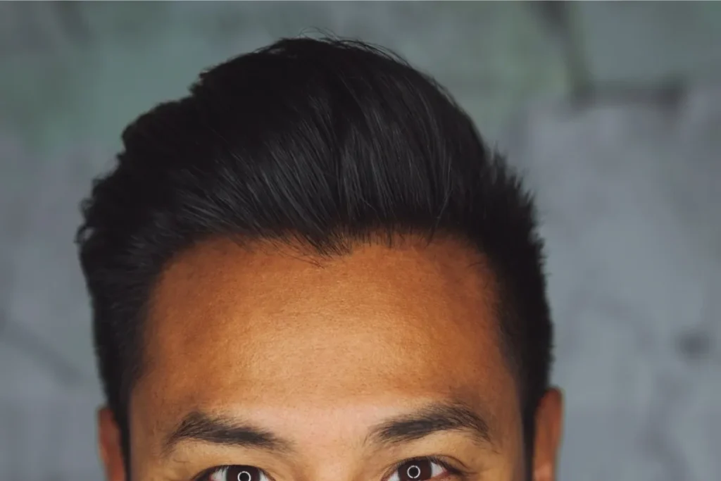 Rogaine For Beard: Amazing Growth Wins