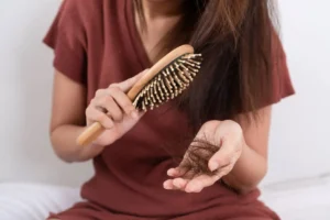 Common Prescription Options: Finasteride and Minoxidil