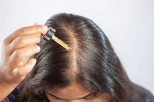 How to Know If Hair Follicles Are Dead – Gold City Hair