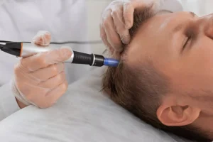 A specialist carefully extracts and implants hair follicles.