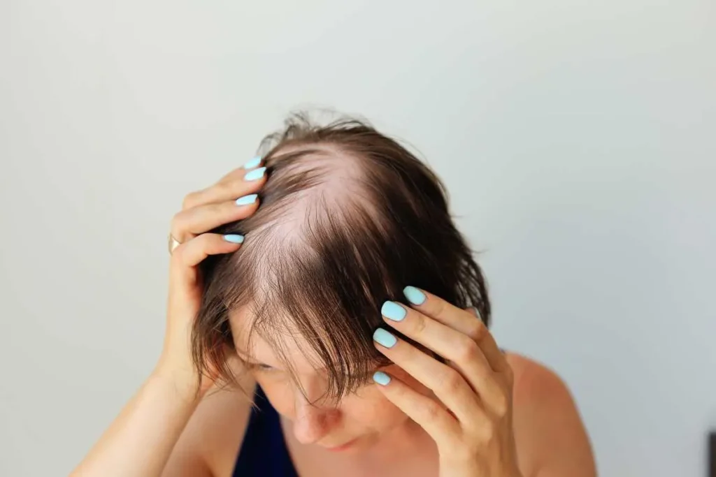 Does Vitamin D3 Help Hair Growth? Facts