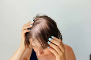 A selection of B‑vitamin supplements that support hair health