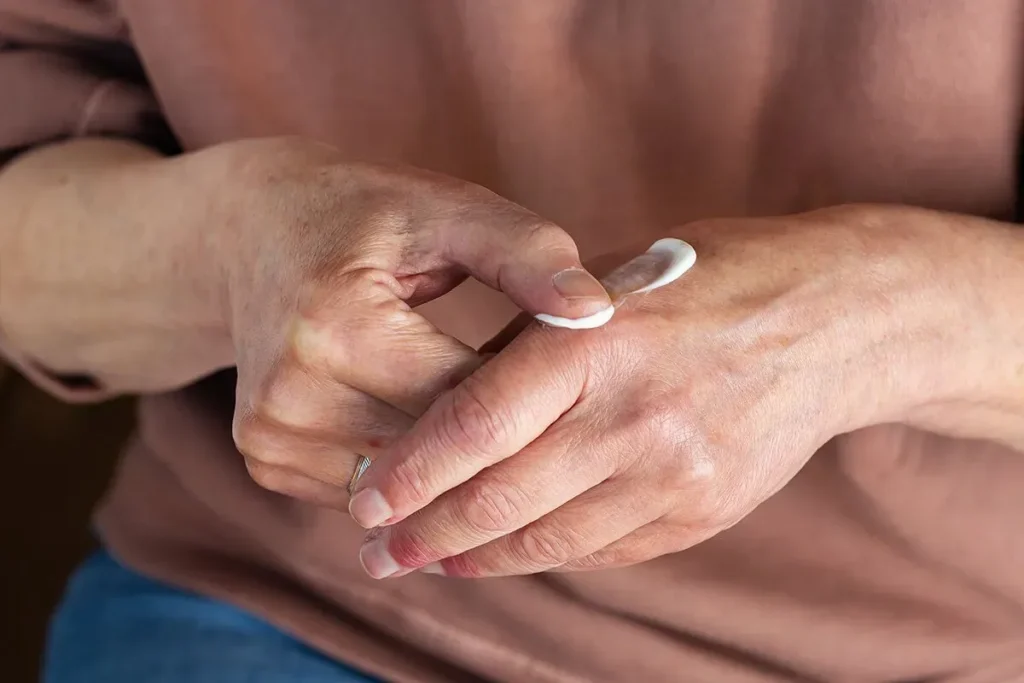 How To Treat Itchy Hands: 5 Best Fast Cures