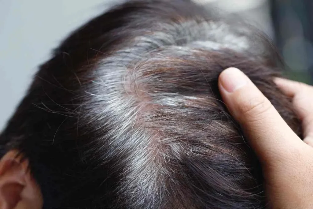 Sores On Scalp: Amazing Powerful Cures
