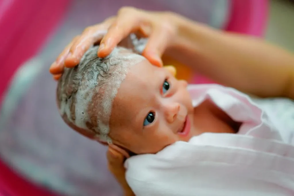 Understanding Adult Cradle Cap (Seborrheic Dermatitis)