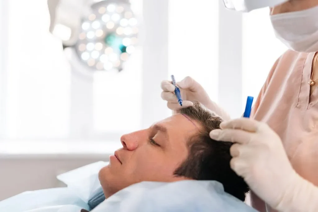 Understanding the Hair Transplant Recovery Timeline