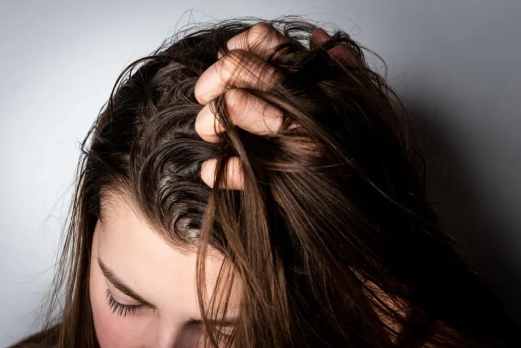 Very Greasy Hair: 7 Fast Incredible Fixes