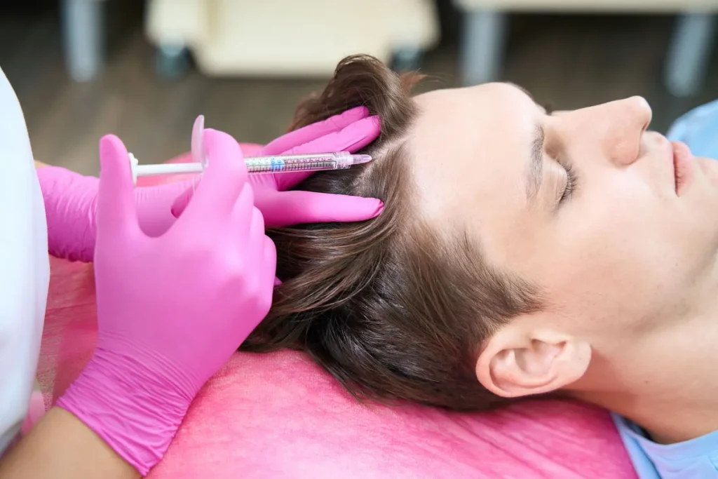 Understanding Hair Injections for Hair Loss
