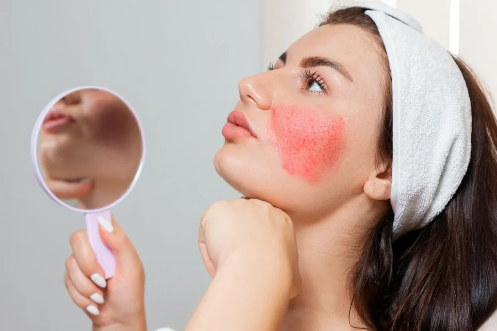 7 Proven Solutions to Reduce Facial Redness