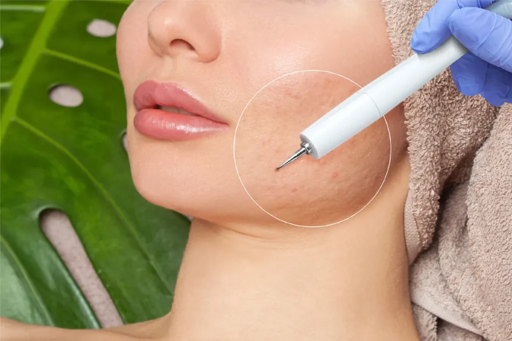 Understanding the Causes of Red Flaky Skin on Face