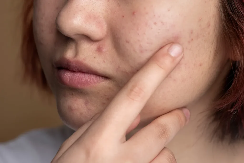 Understanding Common Causes of Scaly Skin