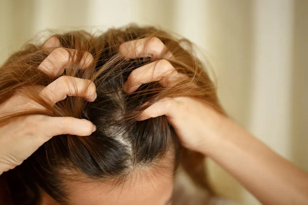 Itchy Scalp: 7 Amazing Powerful Cures