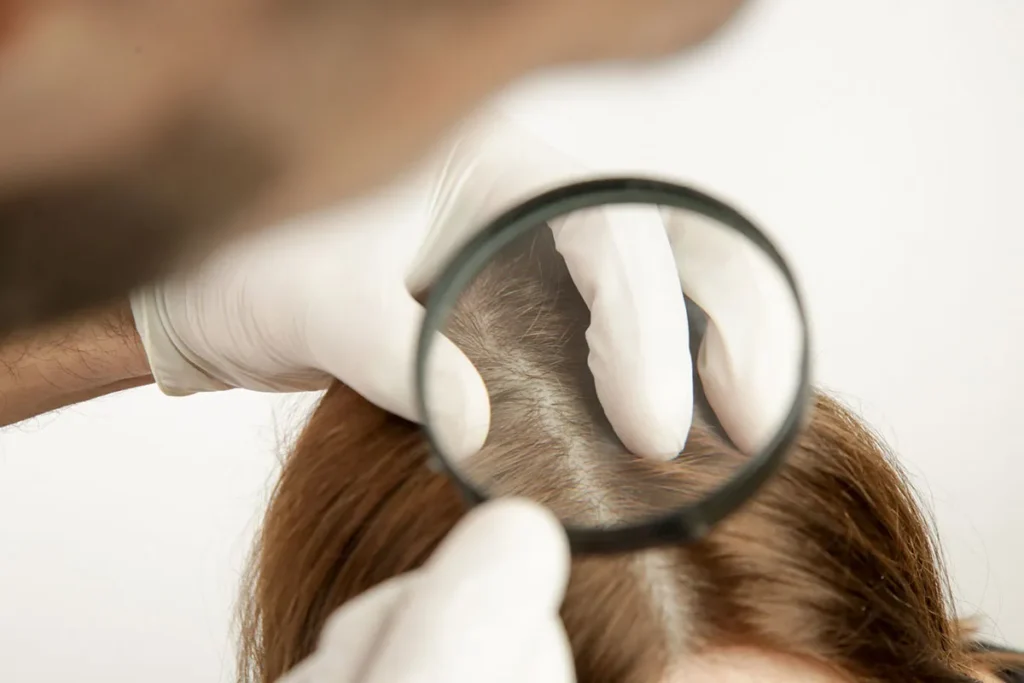 Dry Scalp: Incredible Fast Healing Fix