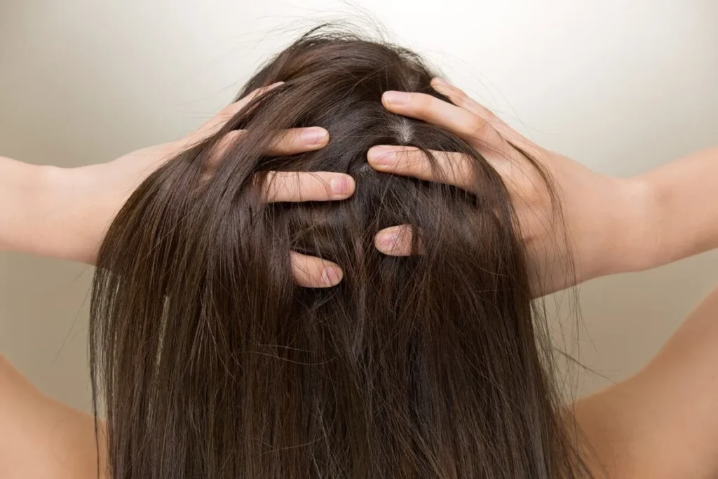 Dry Scalp Treatment: Incredible Power Win