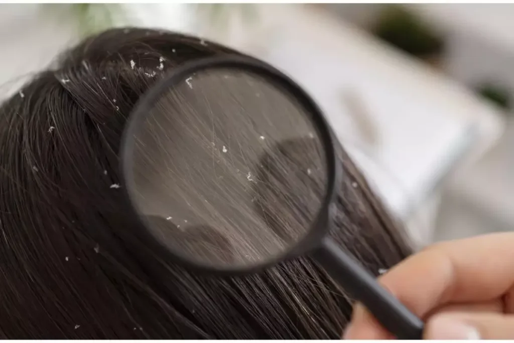 How to Sleep With Curly Hair Without Ruining It