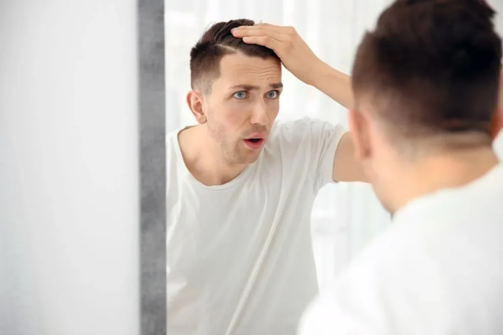 Balding At 18: Scary Truth & Incredible Help