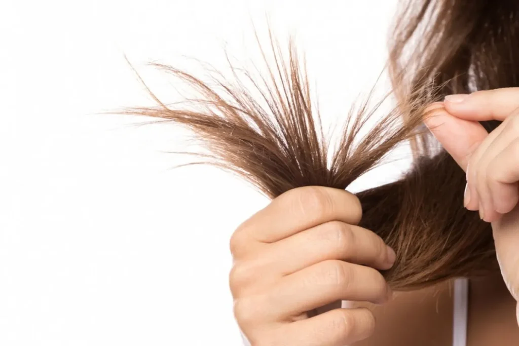 Understanding Why You Have Dry Brittle Hair
