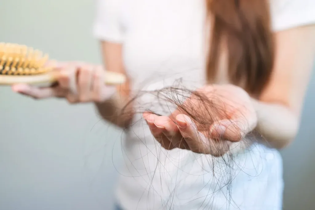 Psoriasis Hair Loss: Scary Signs & Help