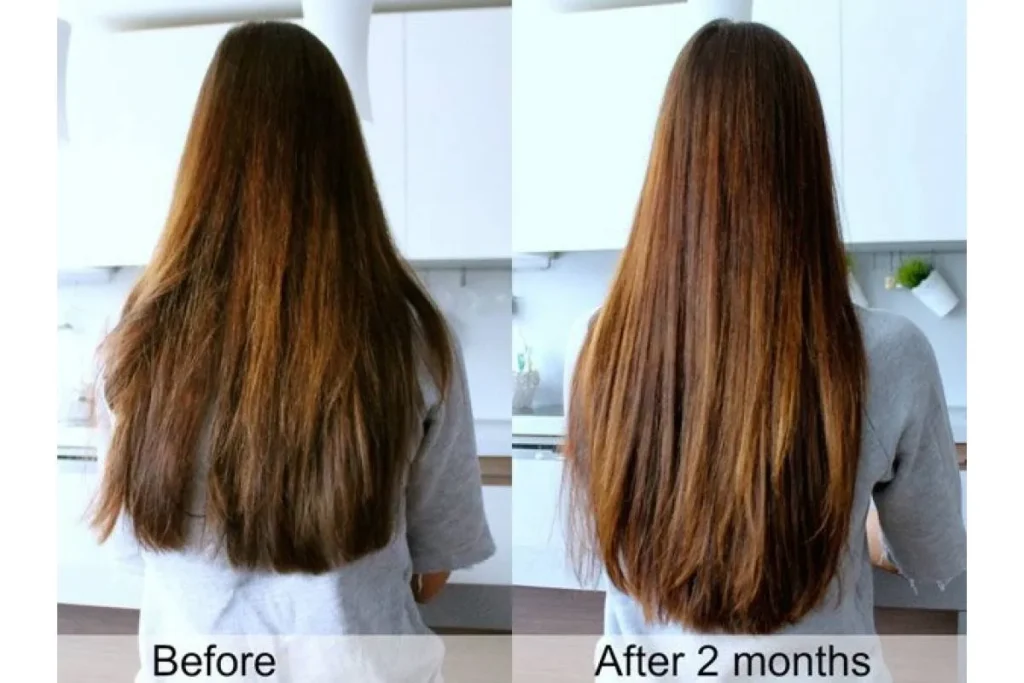 Does Eating Vegetables Help Hair Growth?