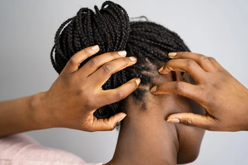 The 7 Best Scalp Treatment Products for Immediate Relief