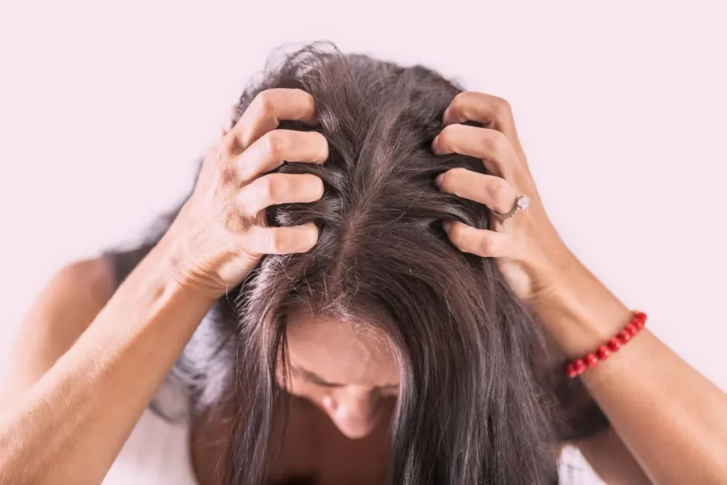 7 Effective Home Remedies for Itchy Scalp