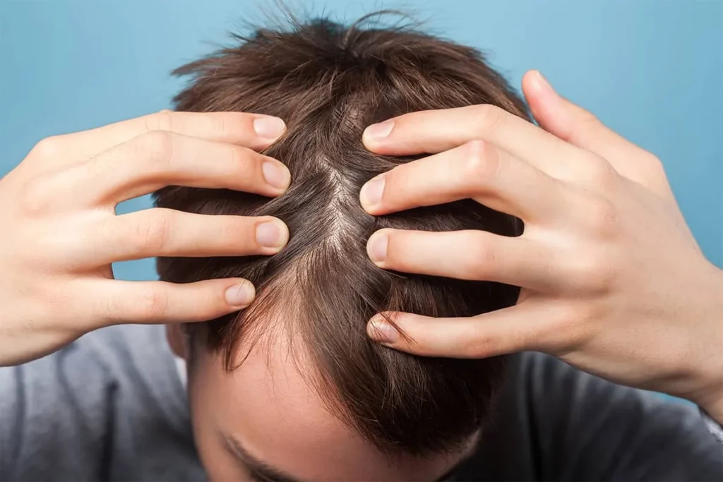 Itchy Scalp: 7 Amazing Powerful Cures