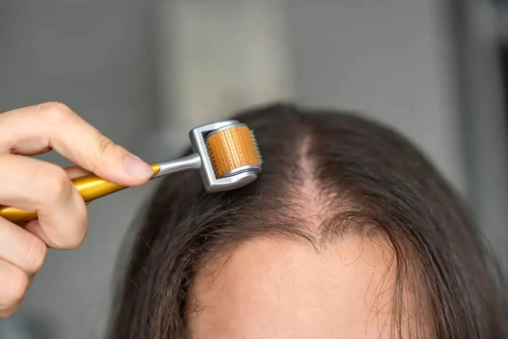 Spironolactone for Hair Loss: Mechanism and Effectiveness