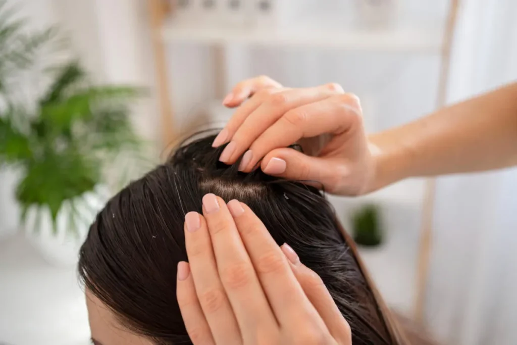 How To Get Rid Of Dry Scalp: Amazing Win