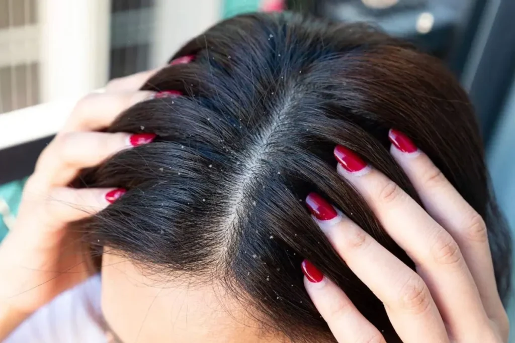 What Causes Male Pattern Baldness? Scary Truth