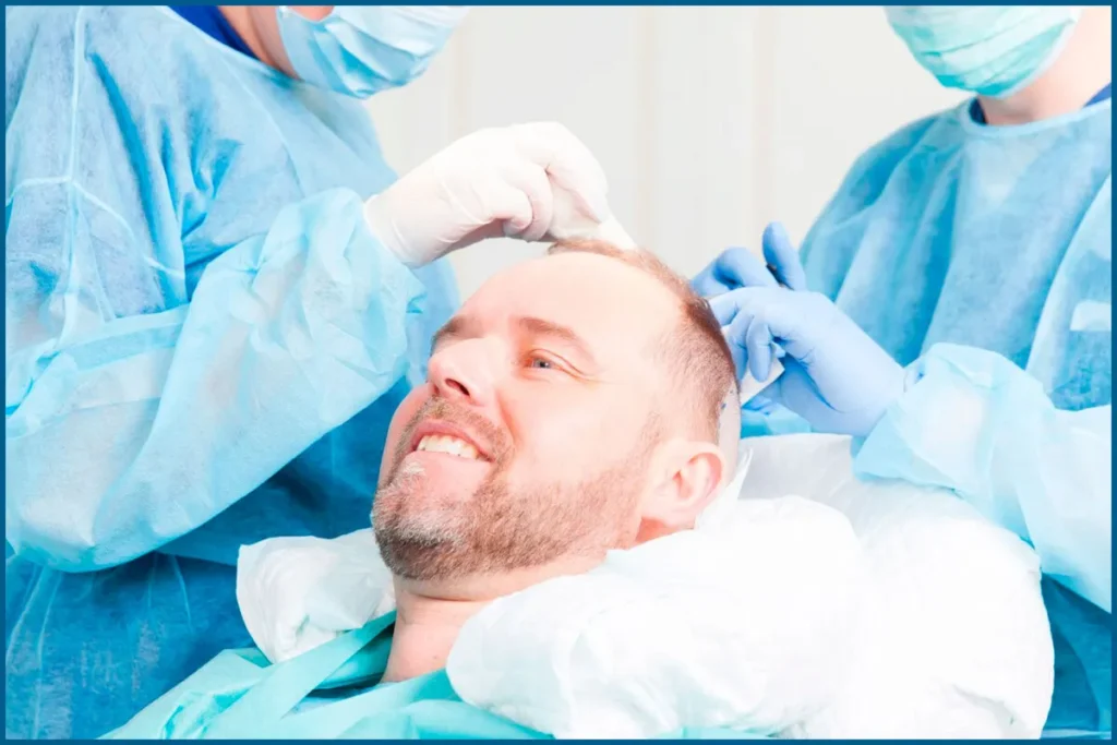 Do Hair Transplants Last Forever? Big Fact