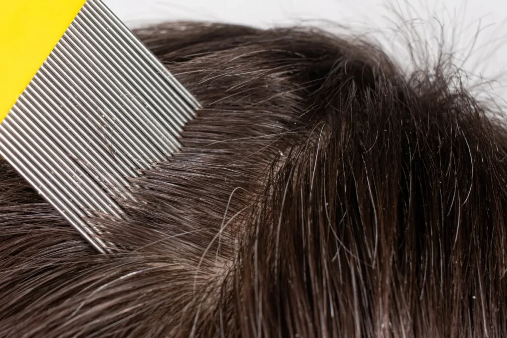 Natural Methods for Thicker, Fuller Hair