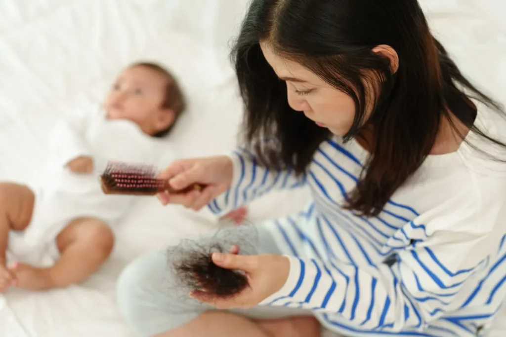 How Long Does Postpartum Hair Loss Last?