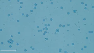 Close‑up of exosomes under a microscope